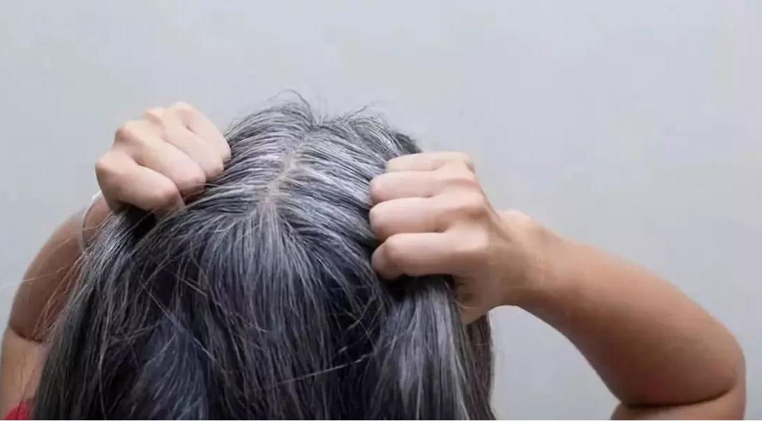 小孩子白头发父母如何正确引导,14岁小孩有白头发怎么办