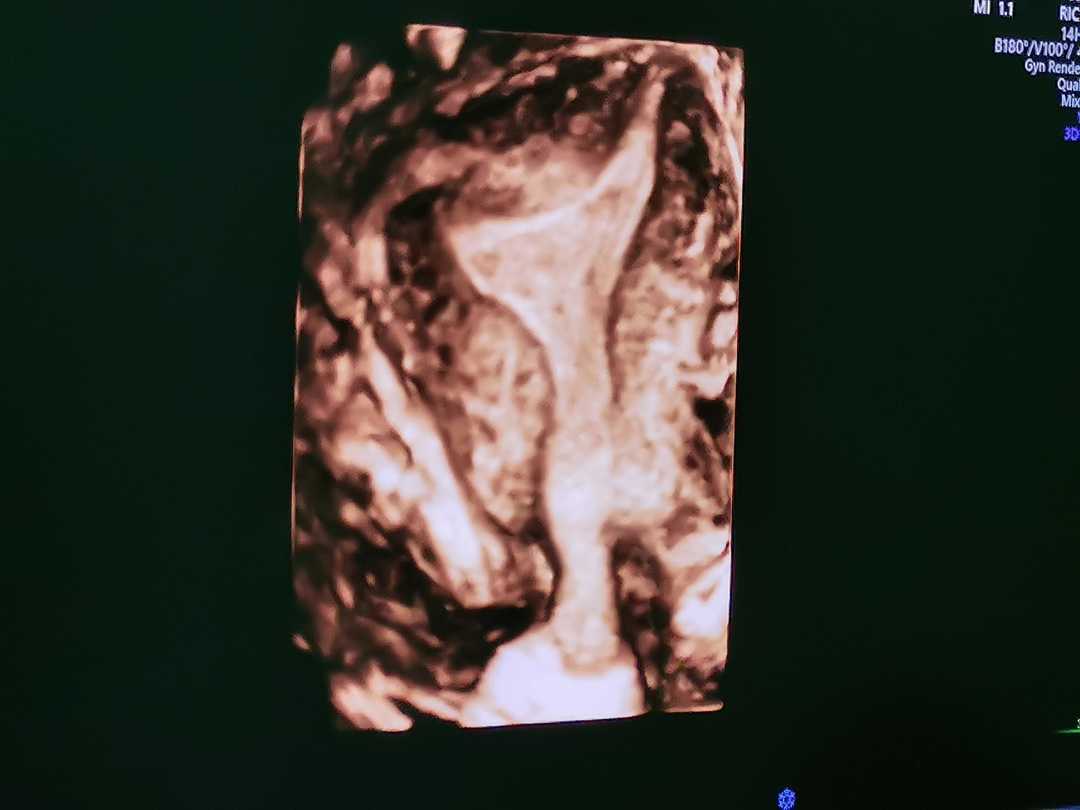 我的培训之路,我的进修生活