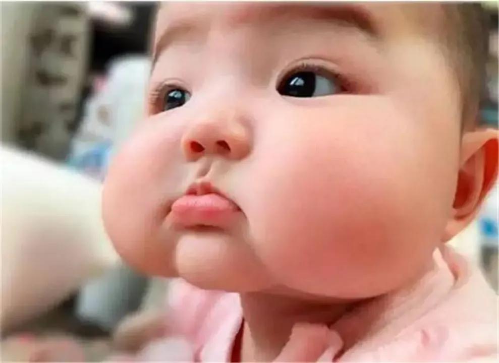 宝宝身体褶皱处发红发干,婴儿褶皱处发红抹什么