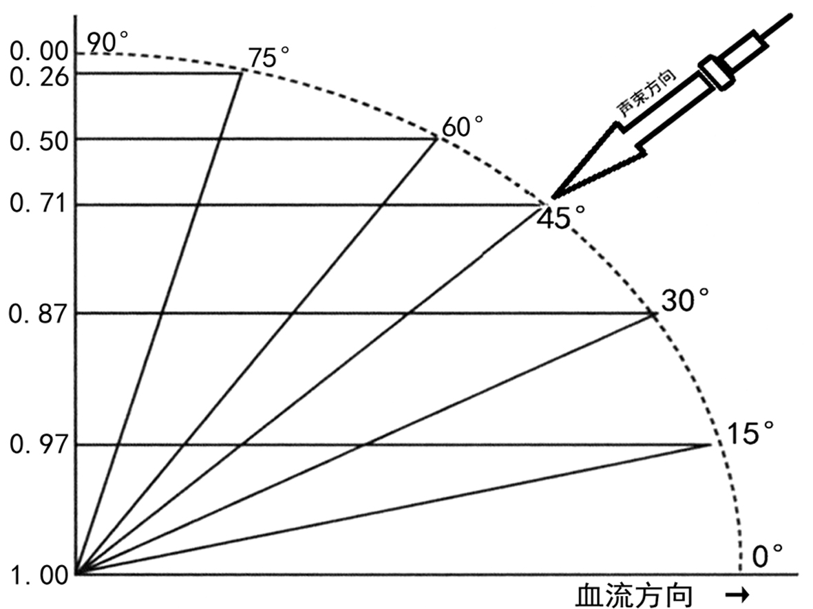 孕期彩色多普勒超声怎么看,多普勒超声检查孕期报告单怎么看