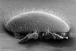 背上起痘有什么办法祛痘,后背祛痘最有效的药膏