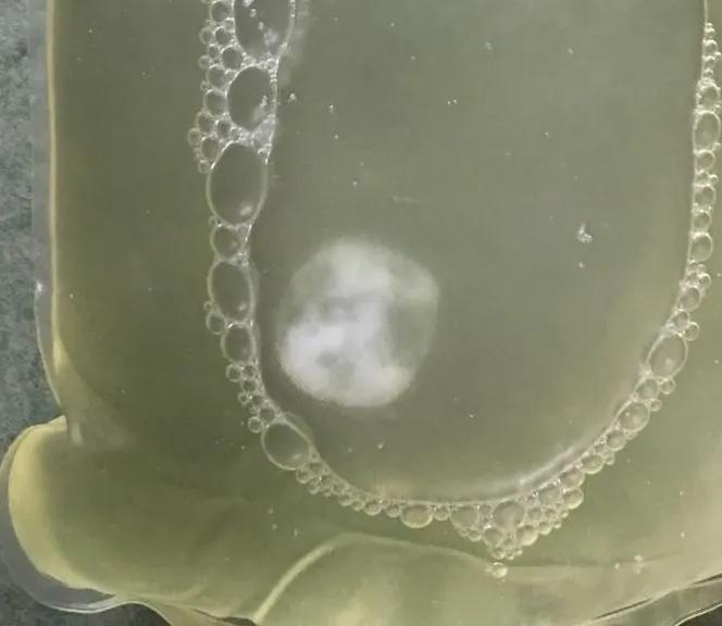 腹膜透析出现腹膜炎的护理措施,腹膜透析居家注意事项