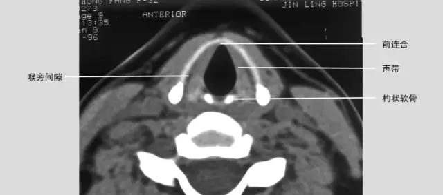 喉部病变做核磁还是ct,耳鼻喉科常见病影像诊断