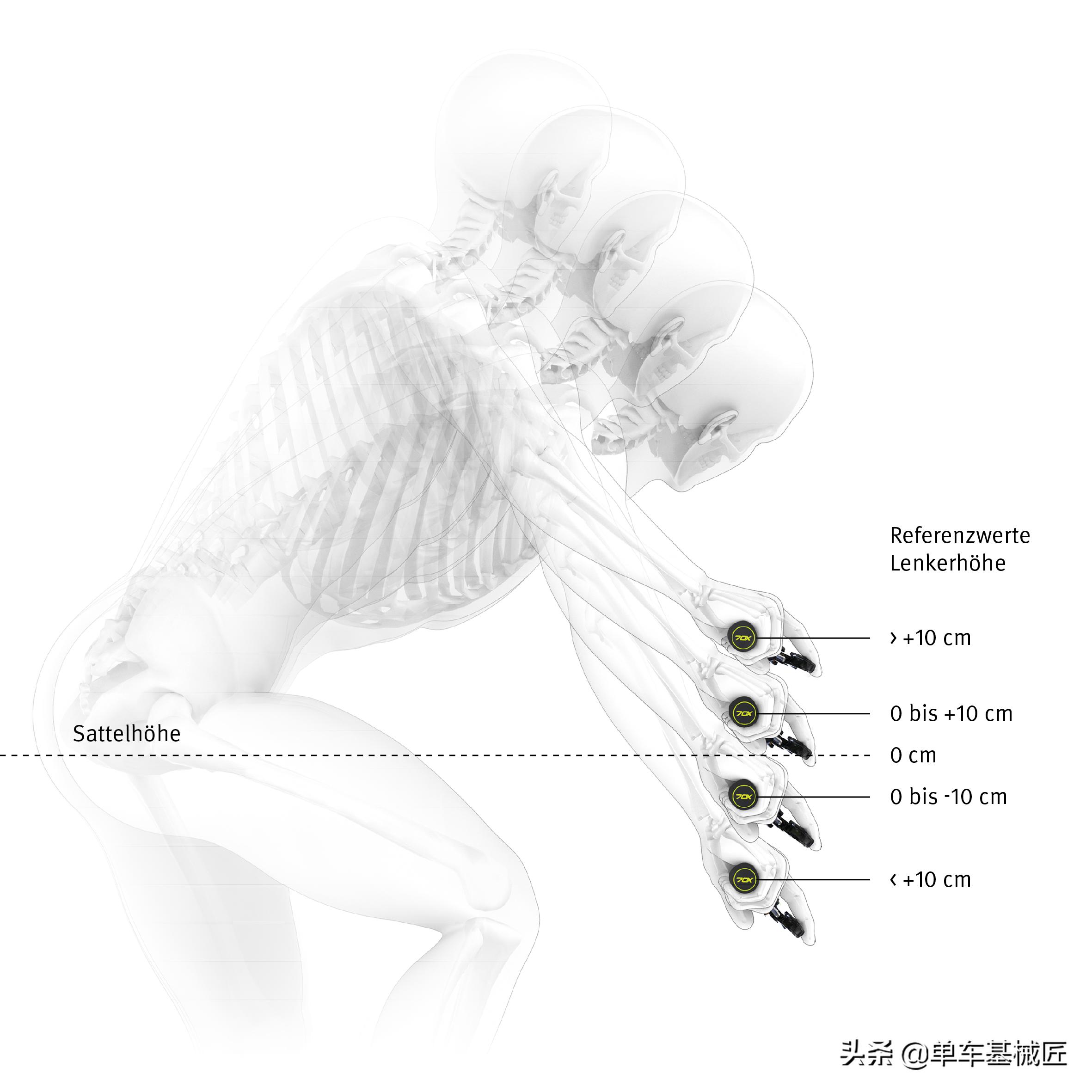 用这三步设置你的刹把,告别手指酸,麻,刺痛,延长运动寿命