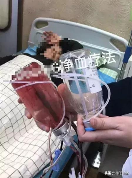 网红带火的化妆品,网红洗血美容