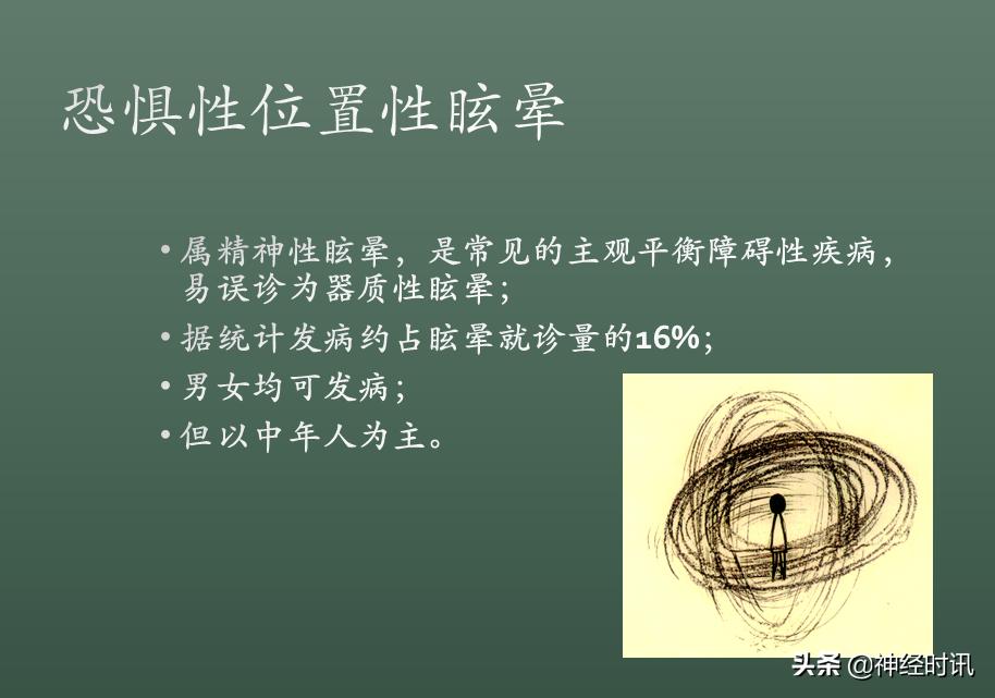 良性位置性眩晕诊断和治疗指南,良性阵发性位置性眩晕的诊断标准
