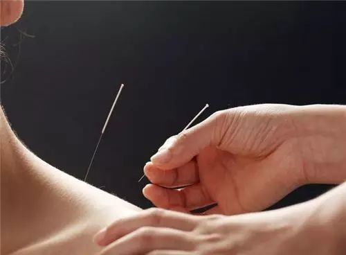 产后修复最佳时间,产后盆底肌肉修复的最佳时机