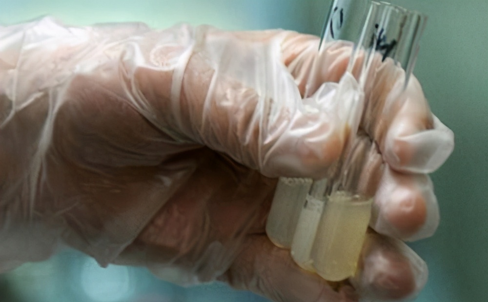 你的精子质量过关吗,你的精子质量