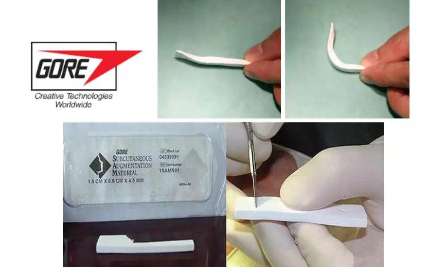 鼻子如何变漂亮,告诉你行业秘密