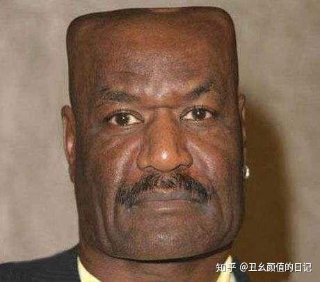 针对三种大饼脸的瘦脸按摩方法,怎么瘦脸解决大小脸