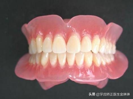 有老虎牙的人会是怎样的,有老虎牙怎么办