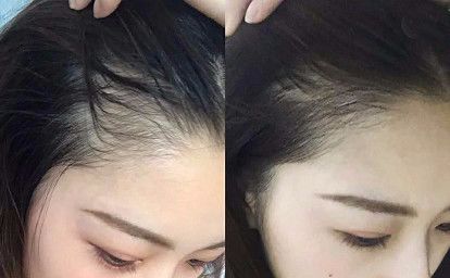 明星护发防掉发秘籍,明星发量增多的秘诀