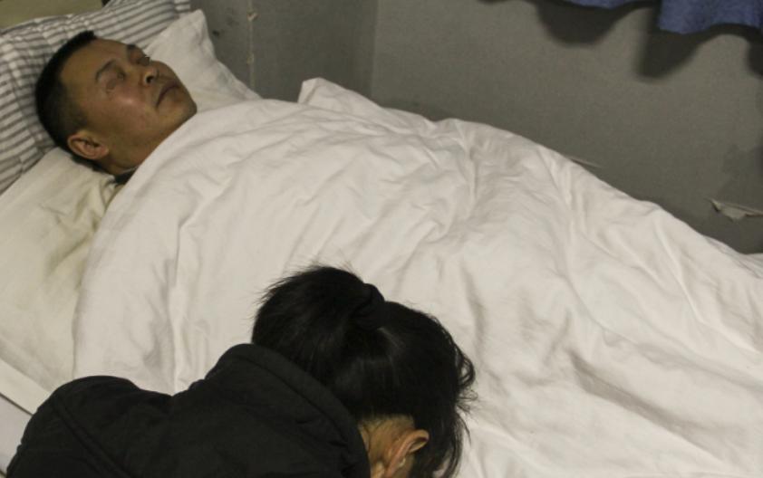 红薯肝硬化的人能吃吗,肝损伤可以吃红薯吗