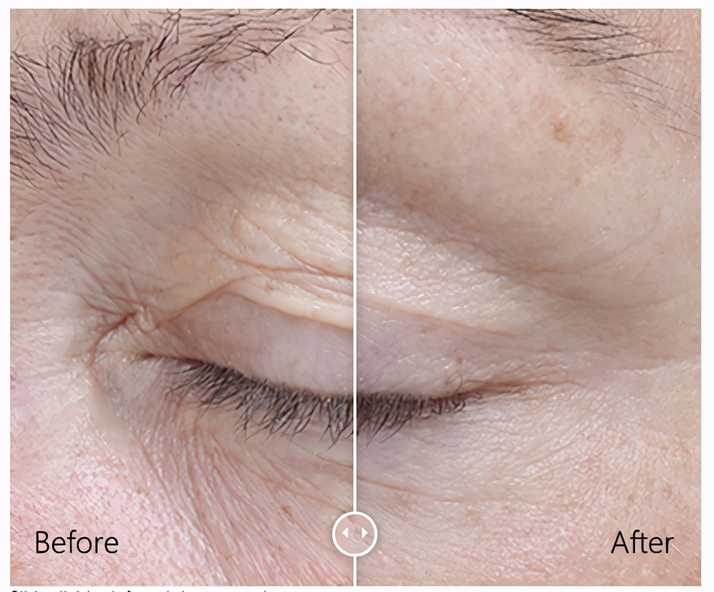 egf生长因子科普视频,表皮生长因子egfr野生型