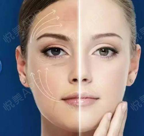 面部衰老改善最好的方法,衰老与面部轮廓的变化