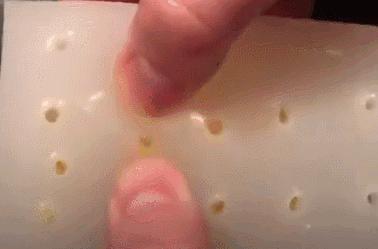 脸上长白色米粒痘痘怎么快速消除,脸上痘痘里面白色米粒是什么东西