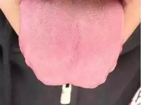 老中医提醒舌头4种异常,舌头一旦出现这个信号马上找中医