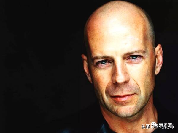 脱发并不难治选对方法很重要,脱发真的无药可救了吗