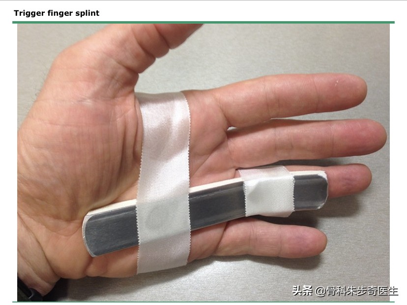 患者故事:今天说说,腱鞘炎究竟应该怎么治疗?需要不需要手术?