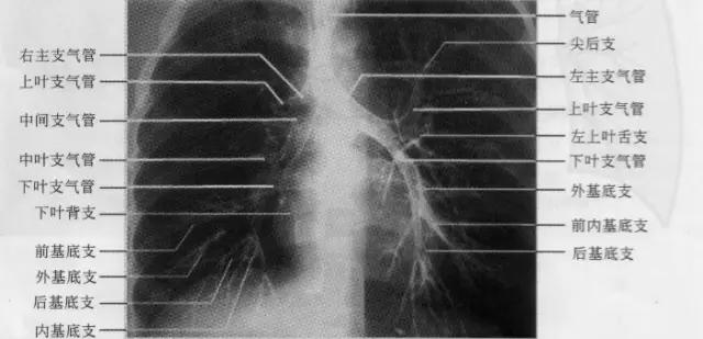 详细的胸部X线解剖，最基础最实用！