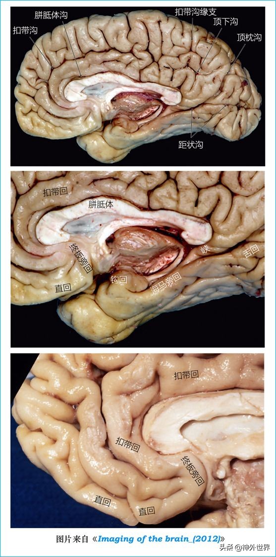 脑解剖学讲解视频全集,脑功能解剖学习