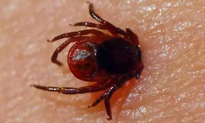 夏天最要小心这四种虫子,在外面遇到这种虫子千万别用手拍