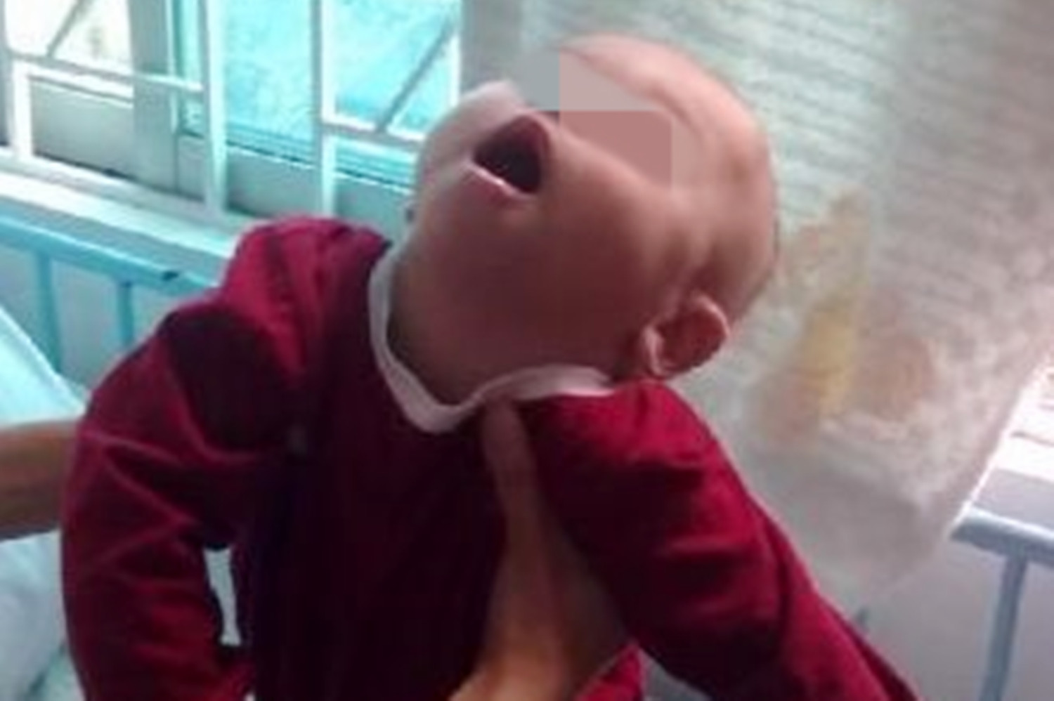 宝宝得了脑瘫怎么办,孩子出现脑瘫的前兆