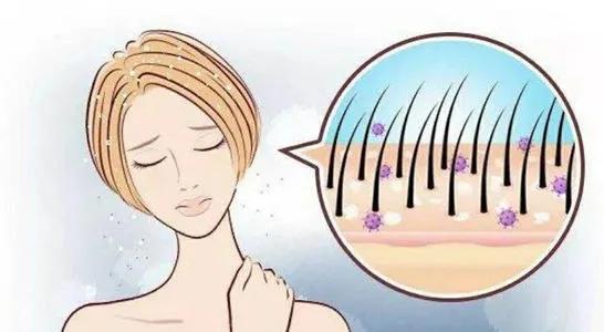 一到秋天头屑多是什么原因引起的,一到秋冬天头屑就多怎么回事