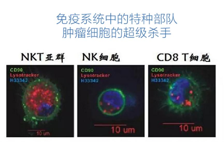 免疫NKT细胞,nkt细胞治疗肿瘤十大科普问题