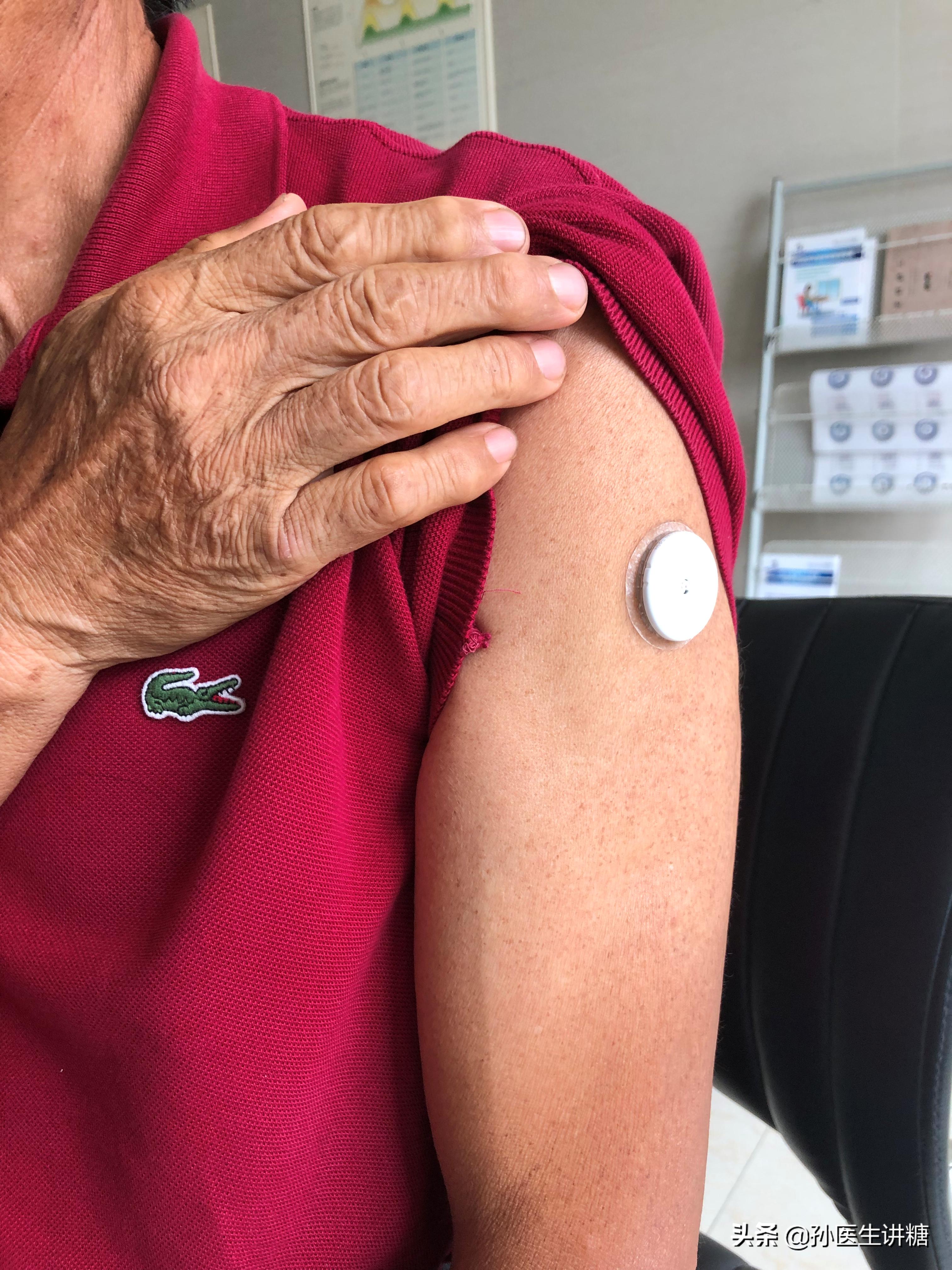 扎手指测血糖手指一直很痛,扎手指测血糖为什么那么痛