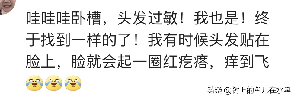 你身边有哪些特殊的体质？网友：我对自己的头发过敏