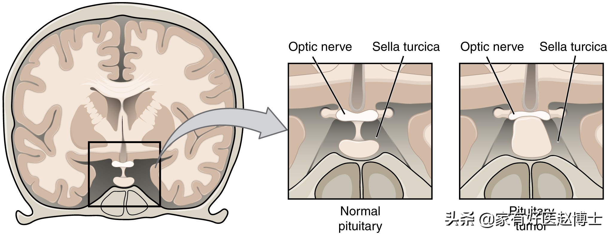 被称为“生理助眠剂”的褪黑素普通片，为何不少人口服效果不佳？