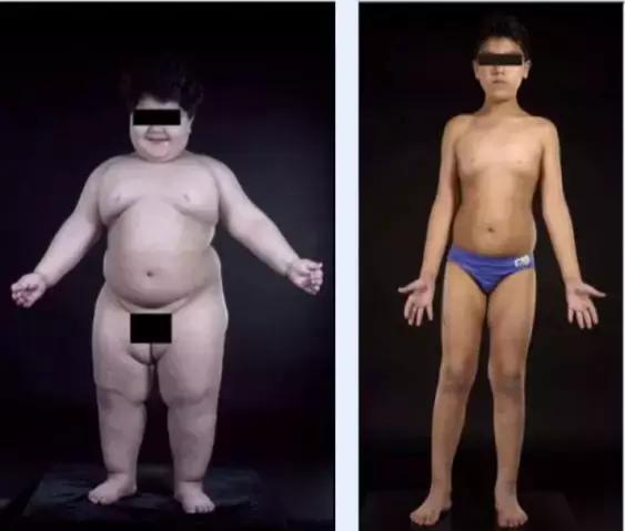 世界公认减肥2天瘦10斤,日本快速减肥法一星期瘦十斤