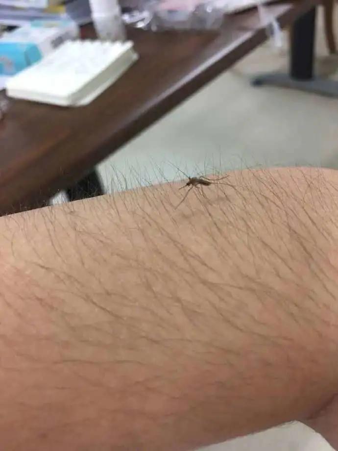 脱毛后总觉得冷飕飕的,脱毛后总觉得腋下粘粘的