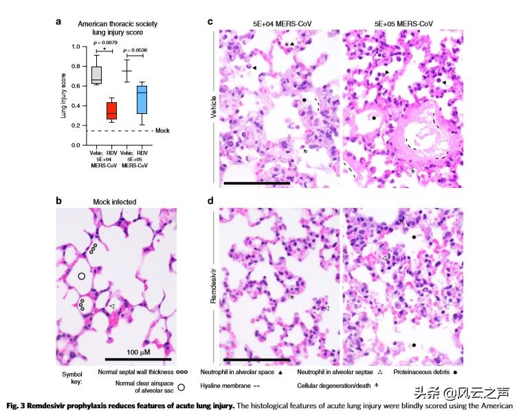十大新冠特效药名单公布,盘点新冠疫苗及治疗药物