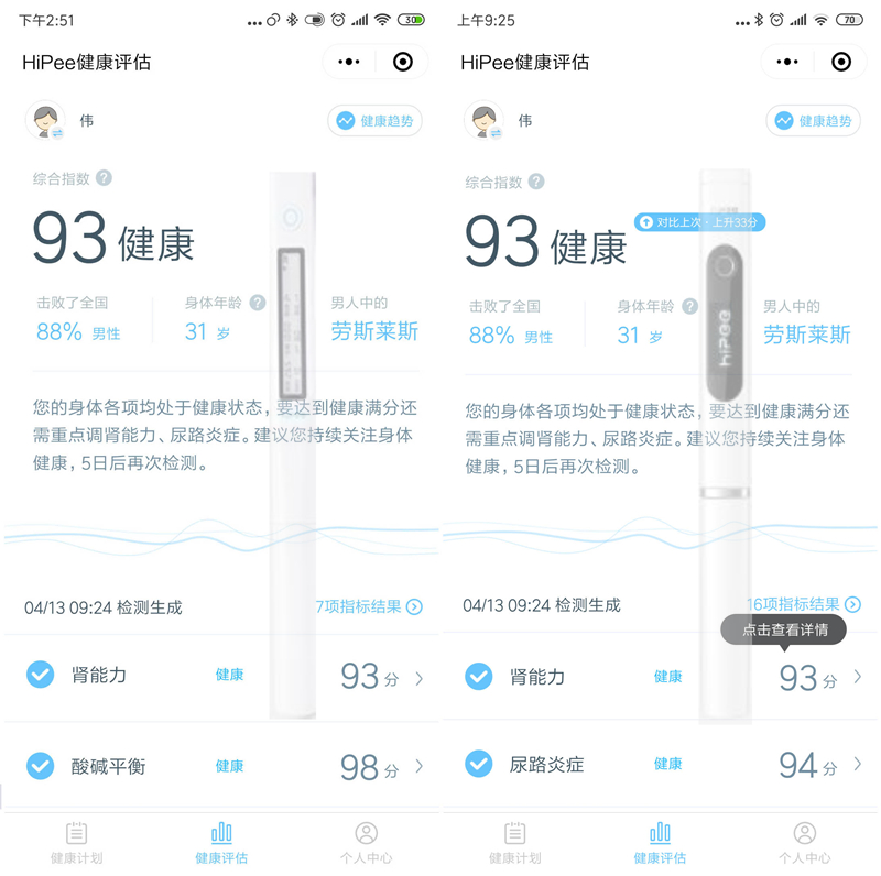 小米hipee智能健康精灵可靠么,小米有品hipee怎么样