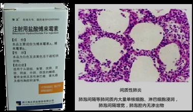 抗肿瘤药，直接影响DNA结构和功能的药物