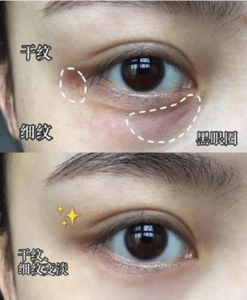 平价好用学生眼霜去黑眼圈,二十出头用的淡化黑眼圈的眼霜