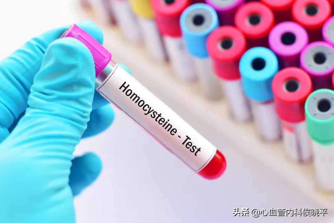 高血压同型半胱氨酸偏高吃叶酸吗,同型半胱氨酸11.3叶酸b6b12怎么吃