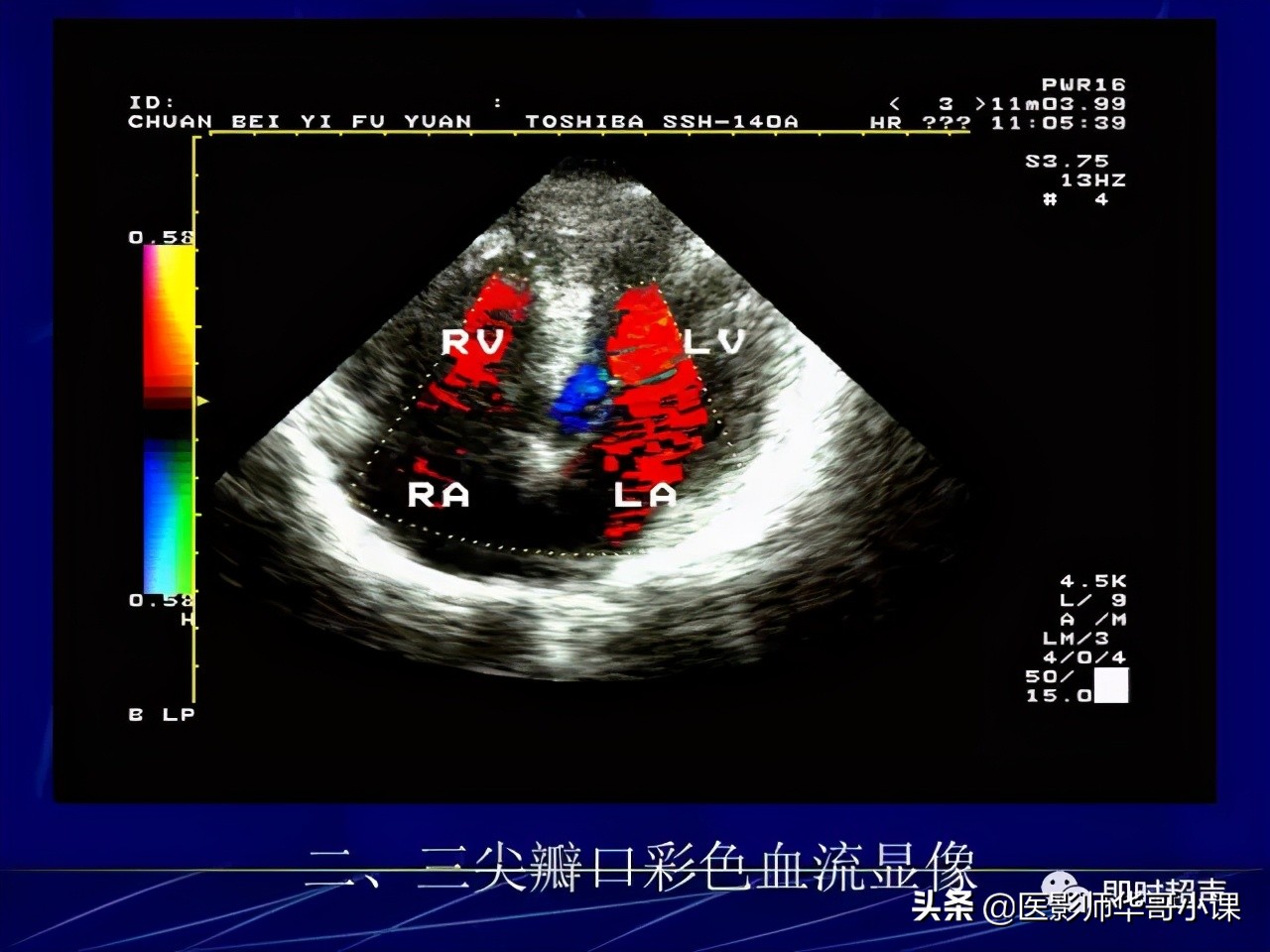 超声检查报告单讲解,超声图像检查