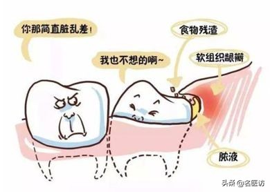 疫情牙痛怎么治疗,疫情期间牙痛用药怎么办