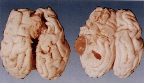 牛羊体外驱虫高效快速好方法,牛羊怎么驱虫才有效