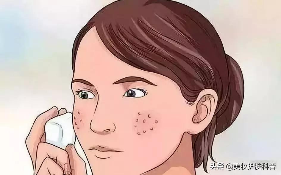 毛孔粗大收缩毛孔最快有效的方法,毛孔粗大怎么办教你一招收缩毛孔
