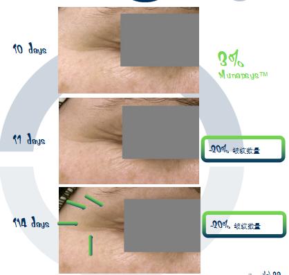 加速女人衰老的5个原因,加快女性衰老的3种原因