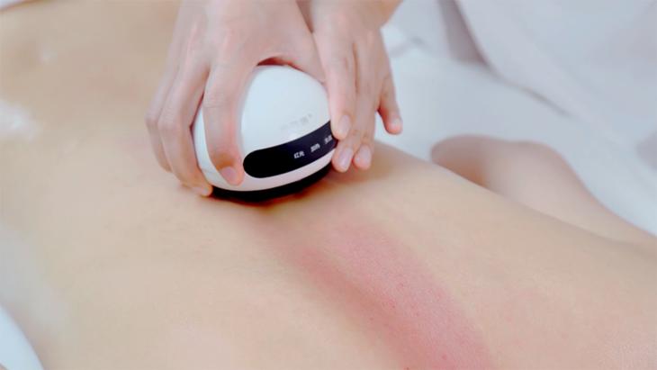 不用火的拔罐器视频,不用火自制拔罐神器