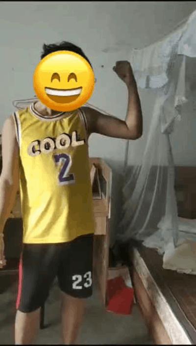 创伤导致肘关节僵硬怎样才能康复,肘关节僵硬康复训练正确方法