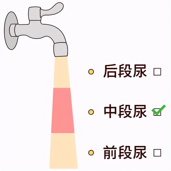 尿常规化验单显示清晰正常吗,尿常规拿到报告单能改结果吗