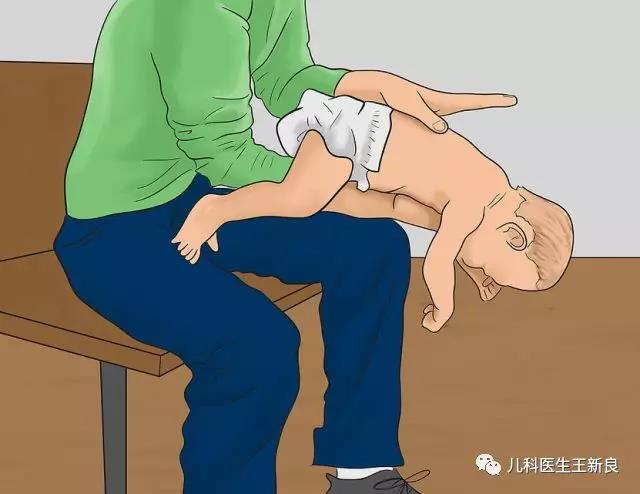 异物卡喉快用海姆立克法抢救,异物卡喉海姆立克急救方法