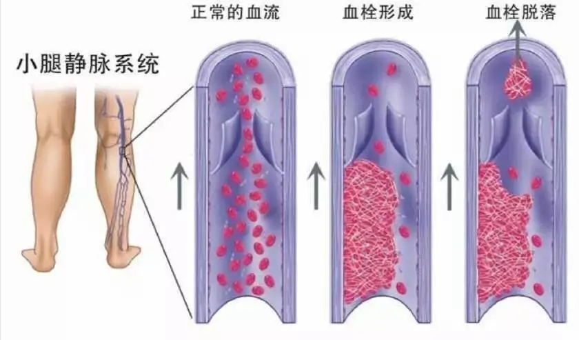 西安红会医院心血管住院部,西安市红会医院心血管内科地址