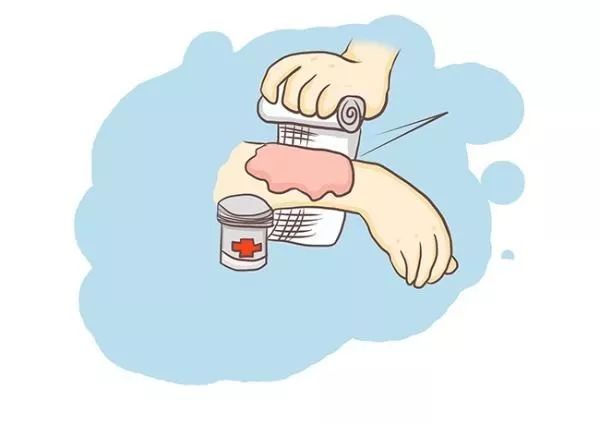 【心分享】新生儿的意外伤害—烫伤